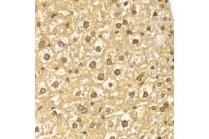Immunohistochemistry of paraffin-embedded mouse liver using PYCARD antibody (ABIN5998640) at dilution of 1/100 (40x lens). (PYCARD anticorps)