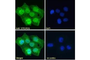 ABIN185681 Immunofluorescence analysis of paraformaldehyde fixed A431 cells, permeabilized with 0.
