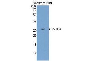 Western Blotting (WB) image for anti-Myosin Light Chain Kinase (MYLK) (AA 1684-1884) antibody (ABIN1859946) (MYLK anticorps  (AA 1684-1884))