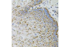 Immunohistochemistry of paraffin-embedded human esophagus using EPO antibody. (EPO anticorps)