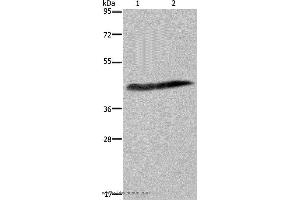 Western blot analysis of Human placenta tissue and HepG2 cell, using CSF2RA Polyclonal Antibody at dilution of 1:250 (CSF2RA anticorps)