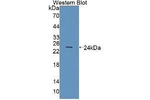 Detection of Recombinant SCCA1/SCCA2, Human using Polyclonal Antibody to Squamous Cell Carcinoma Antigen 1/2 (SCCA1/SCCA2)