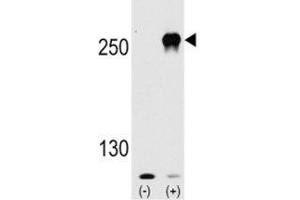 Western blot analysis of mTOR antibody and 293 cell lysate (2 ug/lane) either nontransfected (Lane 1) or transiently transfected with the mTOR gene (2). (MTOR anticorps  (AA 2459-2488))