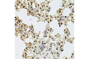 Immunohistochemistry of paraffin-embedded rat lung using ZNF408 antibody.