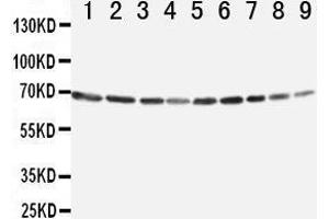 Lane 9: SMMC Cell Lysate (ANXA6 anticorps  (C-Term))
