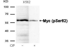 Western blot analysis of extracts from K562 cells, treated with calf intestinal phosphatase (CIP), using Myc (Phospho-Ser62) Antibody. (c-MYC anticorps  (pSer62))