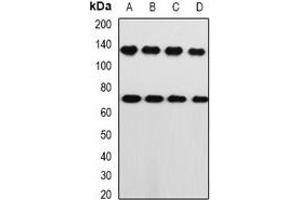 Western blot analysis of PRKG1 expression in A549 (A), PC3 (B), mouse lung (C), mouse heart (D) whole cell lysates. (PRKG1 anticorps)