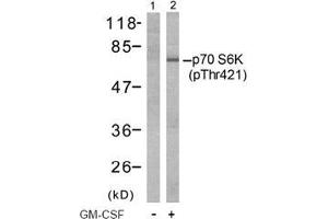 Image no. 2 for anti-Ribosomal Protein S6 Kinase, 70kDa, Polypeptide 1 (RPS6KB1) (pThr421) antibody (ABIN197014) (RPS6KB1 anticorps  (pThr421))