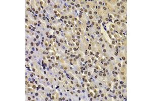 Immunohistochemistry of paraffin-embedded mouse kidney using FBXW7 antibody (ABIN6131632, ABIN6140535, ABIN6140537 and ABIN6221574) at dilution of 1:100 (40x lens). (FBXW7 anticorps  (AA 408-707))