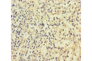 Immunohistochemistry of paraffin-embedded human spleen tissue using ABIN7147970 at dilution of 1:100 (IREM1 anticorps  (AA 20-156))
