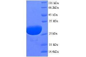 SDS-PAGE (SDS) image for Phospholamban (PLN) (AA 1-52), (full length) protein (GST tag) (ABIN5713740) (Phospholamban Protein (PLN) (AA 1-52, full length) (GST tag))