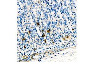 Immunohistochemistry of paraffin embedded rat stomach using ghrelin (ABIN7074040) at dilution of 1:1500 (400x lens) (Ghrelin anticorps)