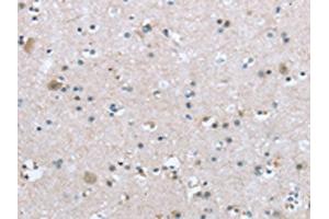 The image on the left is immunohistochemistry of paraffin-embedded Human brain tissue using ABIN7192921(TRPM3 Antibody) at dilution 1/20, on the right is treated with synthetic peptide. (TRPM3 anticorps)
