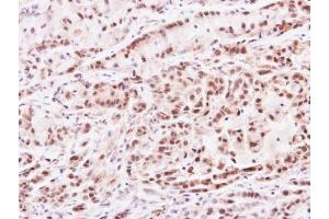 IHC-P Image Immunohistochemical analysis of paraffin-embedded A549 xenograft, using PRMT2, antibody at 1:100 dilution. (PRMT2 anticorps)
