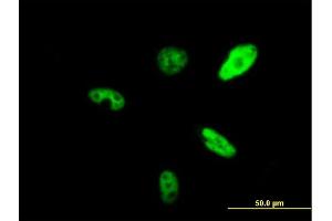 Immunofluorescence of purified MaxPab antibody to SMARCAD1 on HeLa cell. (SMARCAD1 anticorps  (AA 1-1028))