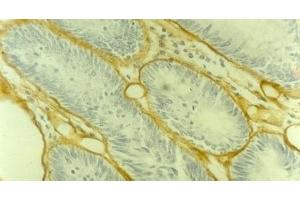 Image no. 1 for anti-Collagen, Type IV (COL4) antibody (ABIN335405) (Collagen IV anticorps)