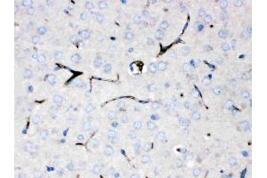 Ceruloplasmin was detected in paraffin-embedded sections of mouse brain tissues using rabbit anti- Ceruloplasmin Antigen Affinity purified polyclonal antibody at (Catalog # ) 1 ?