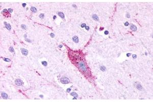 Anti-GPR61 antibody  ABIN1048847 IHC staining of human brain, neurons and glia. (GPR61 anticorps  (C-Term))