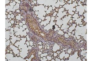 Immunoperoxidase of polyclonal antibody to CTSD (1:200) on paraformaldehyde-fixed paraffin-embedded lung, (Cathepsin D anticorps  (C-Term))
