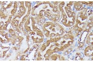 Immunohistochemistry of paraffin-embedded Mouse kidney using DLAT Polyclonal Antibody at dilution of 1:100 (40x lens). (DLAT anticorps)