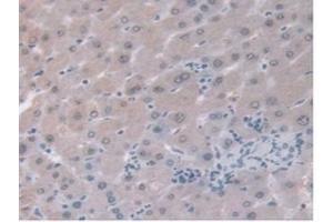 IHC-P analysis of Human Liver Tissue, with DAB staining. (ORM1 anticorps  (AA 19-201))