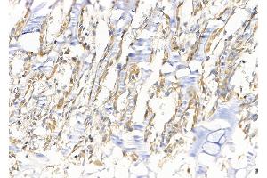 ABIN6265355 and ABIN6279867 at 1/100 staining Rat muscle tissue by IHC-P.