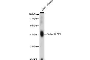 Western blot analysis of extracts of Human plasma, using Factor IX / F9 antibody (ABIN3022173, ABIN3022174, ABIN3022175, ABIN1512886 and ABIN6218646) at 1:1000 dilution. (Coagulation Factor IX anticorps  (AA 29-192))