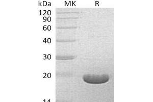 Western Blotting (WB) image for Bifunctional Apoptosis Regulator (BFAR) protein (ABIN7321012) (BFAR Protéine)