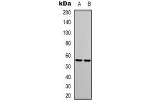 Western blot analysis of RUNX1 expression in Jurkat (A), THP1 (B) whole cell lysates. (RUNX1 anticorps)
