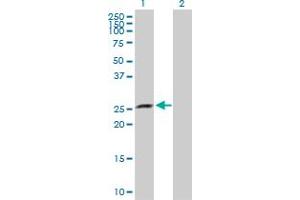 Western Blot analysis of XRCC6BP1 expression in transfected 293T cell line by XRCC6BP1 MaxPab polyclonal antibody. (XRCC6BP1 anticorps  (AA 1-246))
