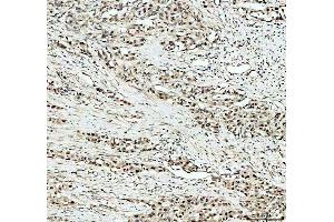 IHC analysis of KAT1/HAT1 using anti-KAT1/HAT1 antibody (ABIN7603224). (HAT1 anticorps  (N-Term))