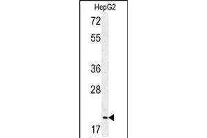 Western blot analysis of in HepG2 cell line lysates (35ug/lane)