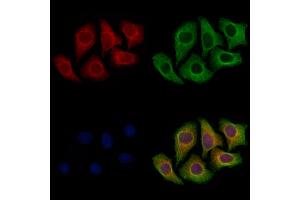 ABIN7094866 and ABIN7098918 staining Hela cells by IF/ICC.