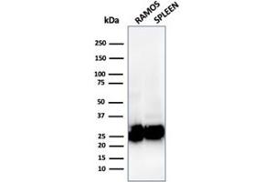 Western Blot Analysis of (1) Ramos cell and (2) human spleen tissue lysate using HLA-Pan Mouse Recombinant Monoclonal Antibody (rHLA-Pan/3475).