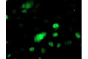 Anti-PHF21B mouse monoclonal antibody (ABIN2454829) immunofluorescent staining of COS7 cells transiently transfected by pCMV6-ENTRY PHF21B (RC204284). (PHF21B anticorps)
