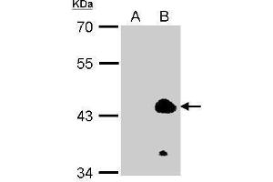 WB Image Sample (100ug of whole cell lysate) A: 293T (mock) B: 293T transfected KLF1 antibody diluted at 1:2000