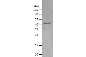 Western Blotting (WB) image for Arrestin, beta 1 (ARRB1) (AA 1-418) protein (His-IF2DI Tag) (ABIN7121897)