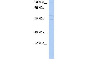 WB Suggested Anti-SGK3 Antibody Titration: 0. (SGK3 anticorps  (N-Term))