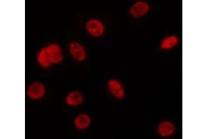 ABIN6275687 staining Hela by IF/ICC. (ZC3H13 anticorps  (C-Term))