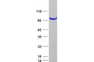Validation with Western Blot