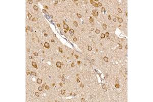 Immunohistochemistry of paraffin-embedded rat brain using ERp19 Rabbit mAb (ABIN7270799) at dilution of 1:200 (40x lens).