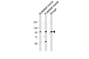 Western Blot at 1:2000 dilution Lane 1: mouse skeletal muscle lysate Lane 2: rat skeletal muscle lysate Lane 3: mouse heart lysate Lysates/proteins at 20 ug per lane. (CSF1R anticorps  (C-Term))