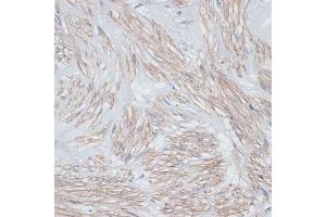 Immunohistochemistry of paraffin-embedded human uterus using Tropomyosin 1 antibody (ABIN3021577, ABIN3021578, ABIN3021579, ABIN1513635 and ABIN6215262) at dilution of 1:100 (40x lens).