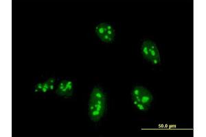Immunofluorescence of monoclonal antibody to NANOG on HeLa cell. (Nanog anticorps  (AA 98-195))