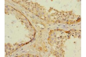 Immunohistochemistry of paraffin-embedded human testis tissue using ABIN7161916 at dilution of 1:100 (NRBP1 anticorps  (AA 406-535))