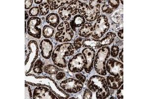 Immunohistochemical staining of human kidney with OGDH polyclonal antibody  shows strong cytoplasmic positivity in cells of tubules at 1:50-1:200 dilution. (alpha KGDHC anticorps)