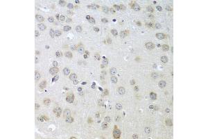 Immunohistochemistry of paraffin-embedded mouse brain using ACHE antibody (ABIN5974721) at dilution of 1/100 (40x lens). (Acetylcholinesterase anticorps)