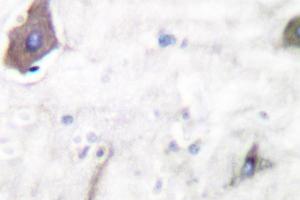 Image no. 1 for anti-Prostaglandin-Endoperoxide Synthase 1 (Prostaglandin G/H Synthase and Cyclooxygenase) (PTGS1) (pSer585) antibody (ABIN265370)