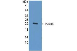 anti-Superoxide Dismutase 1, Soluble (SOD1) (AA 2-154) antibody