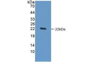 Western blot analysis of recombinant Horse SOD1. (SOD1 anticorps  (AA 2-154))
